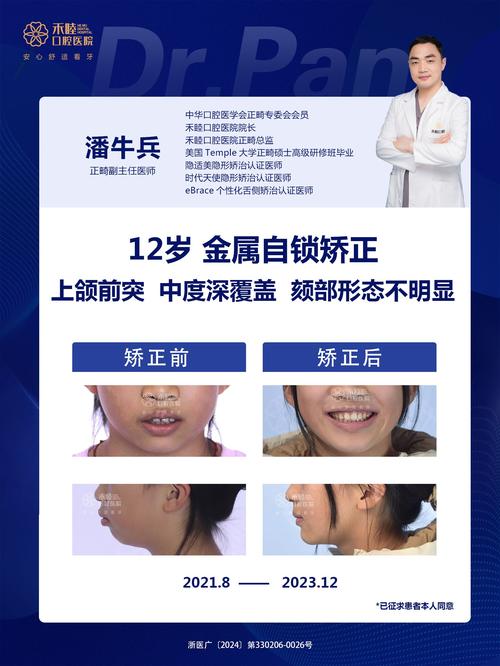 错合畸形的治疗方法有哪些？如何根据畸形类型选择？-图1