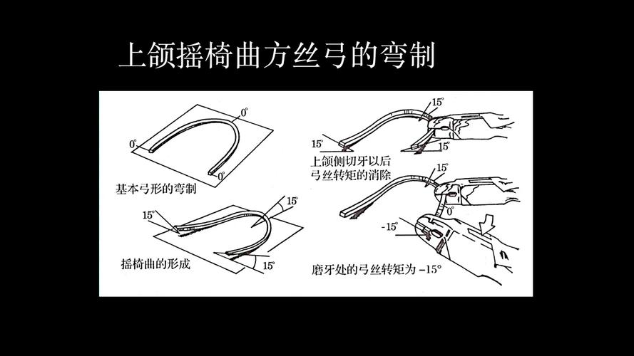 正畸摇椅弓弯制方法-图1