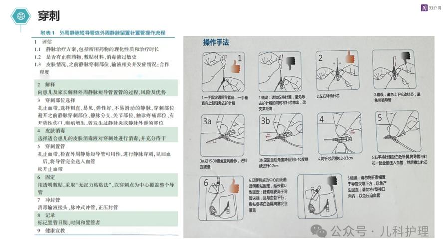 断针病人发生后,正确处理的具体方法和步骤有哪些?-图2 断针病人发生后,正确处理的具体方法和步骤有哪些?-图2