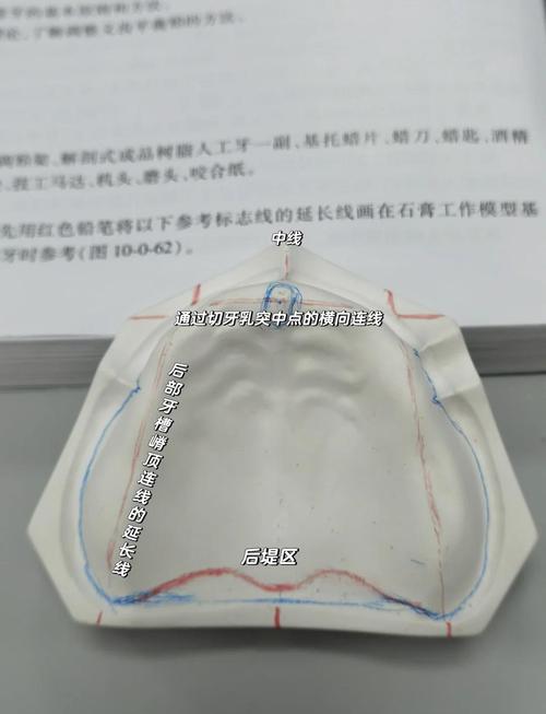 种植牙模型制作的具体方法有哪些？详细步骤与材料清单是什么？-图1
