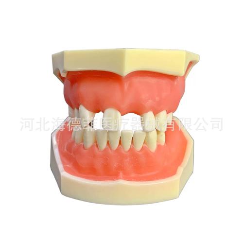 种植牙模型制作的具体方法有哪些？详细步骤与材料清单是什么？-图3