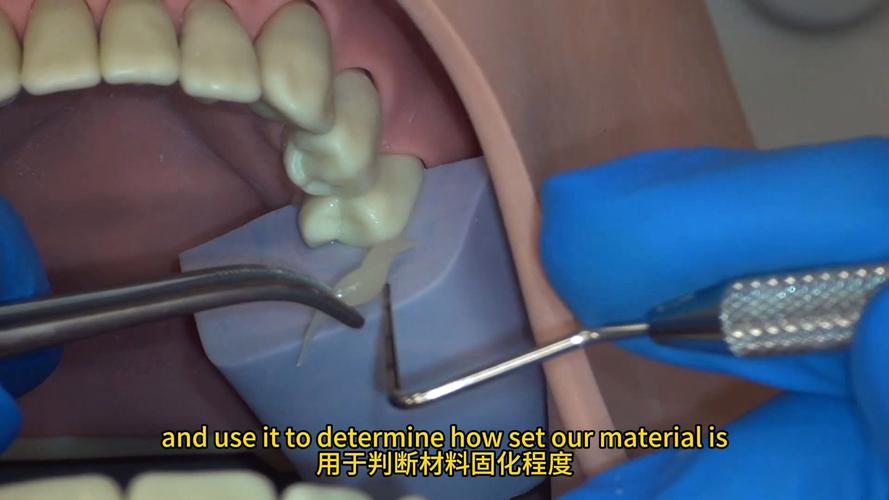 临时牙制作方法图片-图2