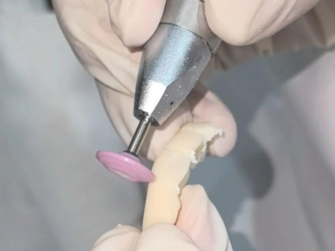 临时牙制作方法图片-图1