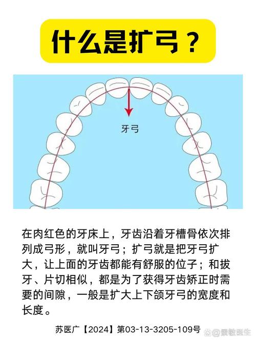 面弓矫正的使用方法是什么？正确操作步骤与注意事项详解-图3