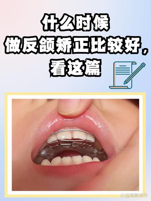 乳前牙反合的治疗方法有哪些？不同病例如何针对性选择？-图3