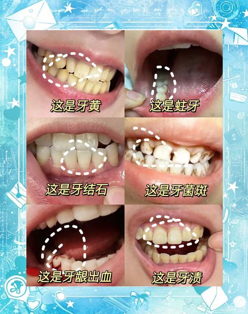 儿童美白牙齿的方法有哪些？如何确保安全与效果？-图2