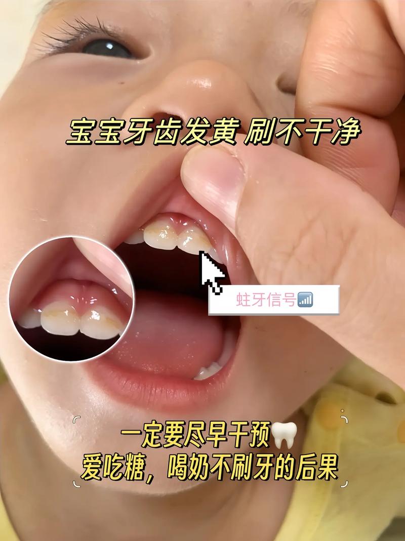 儿童美白牙齿的方法有哪些？如何确保安全与效果？-图3