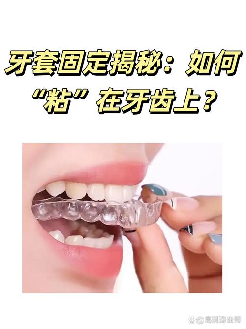 牙齿粘托槽矫正方法如何操作？详细步骤和注意事项有哪些？-图1