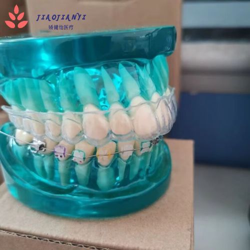 正畸陶瓷托槽碎了一块-图2 正畸陶瓷托槽碎了一块-图2