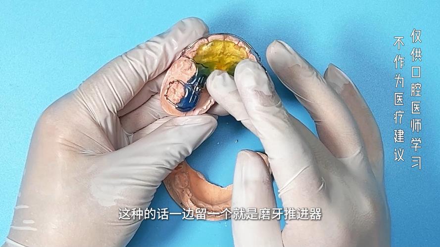 磨牙推进器如何正确安装？步骤与要点是什么？-图2