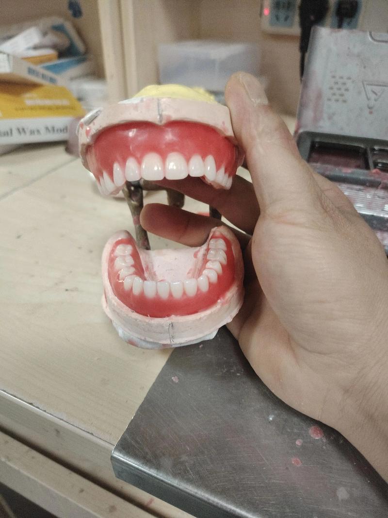 树脂假牙制作方法的具体步骤和所需材料有哪些?-图2 树脂假牙制作方法的具体步骤和所需材料有哪些?-图2