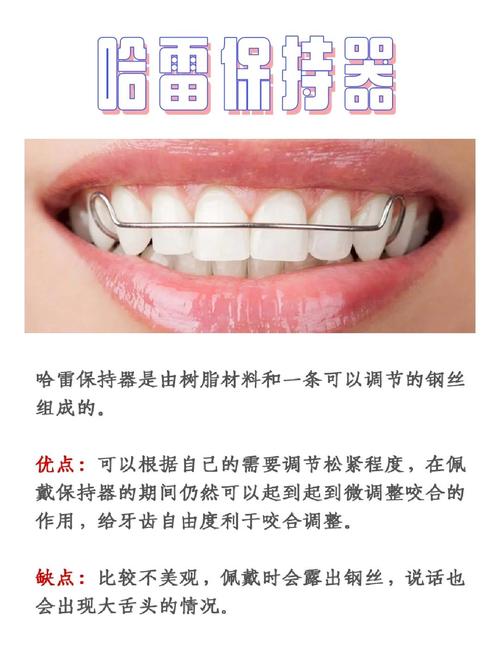 正畸保持器上下怎么分?区分方法与佩戴要点-图1 正畸保持器上下怎么分?区分方法与佩戴要点-图1