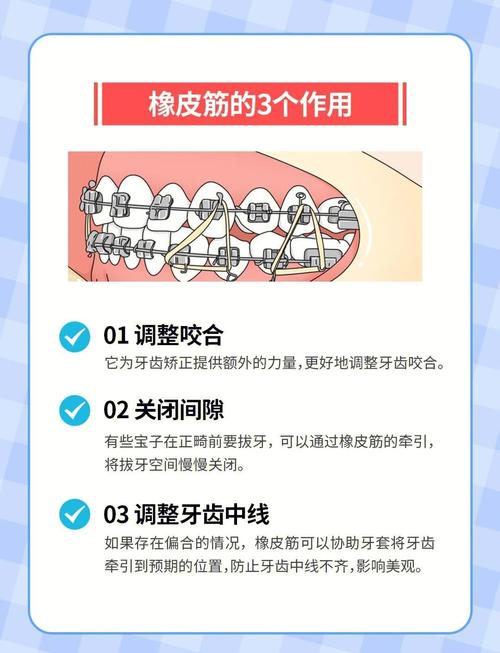 正畸牙的皮筋要怎么挂-图1 正畸牙的皮筋要怎么挂-图1