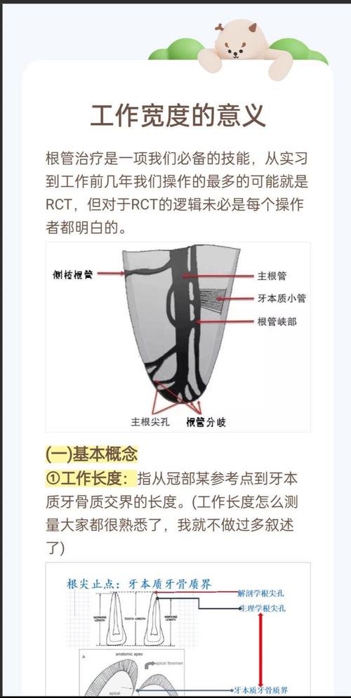 临床上如何准确确认根管长度的常用方法有哪些?-图1 临床上如何准确确认根管长度的常用方法有哪些?-图1
