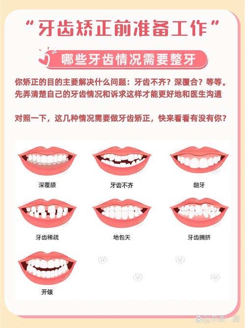 种牙可以矫正牙齿么-图1 种牙可以矫正牙齿么-图1