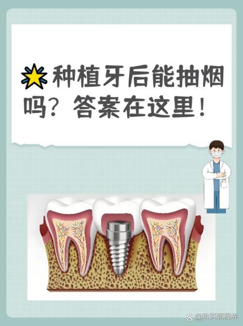 种牙之后不能抽烟吗-图3