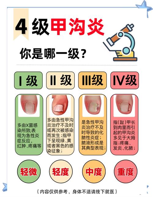 牙沟炎的最佳治疗方法是什么？如何选择最有效的治疗方式并预防复发？-图2