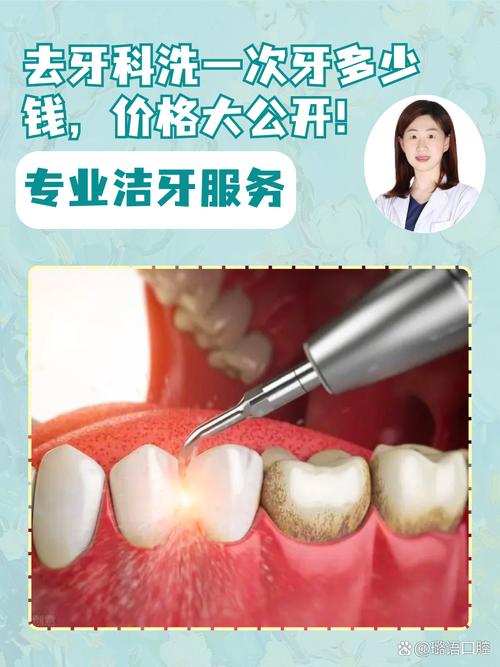 口腔超声波洁牙方法怎么做?过程安全吗?-图3 口腔超声波洁牙方法怎么做?过程安全吗?-图3
