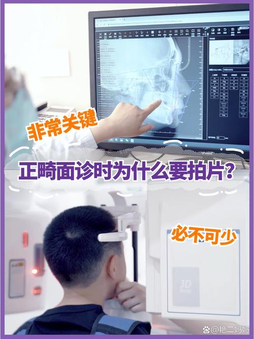 上海口腔正畸必须拍片吗?-图3 上海口腔正畸必须拍片吗?-图3