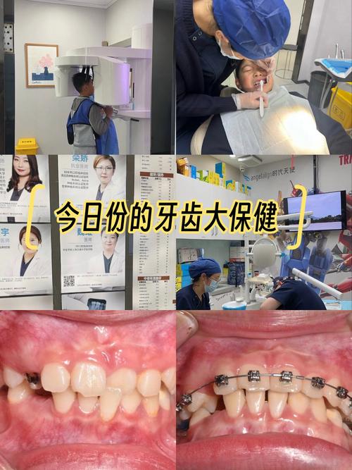 北京口腔王府井 正畸-图2 北京口腔王府井 正畸-图2