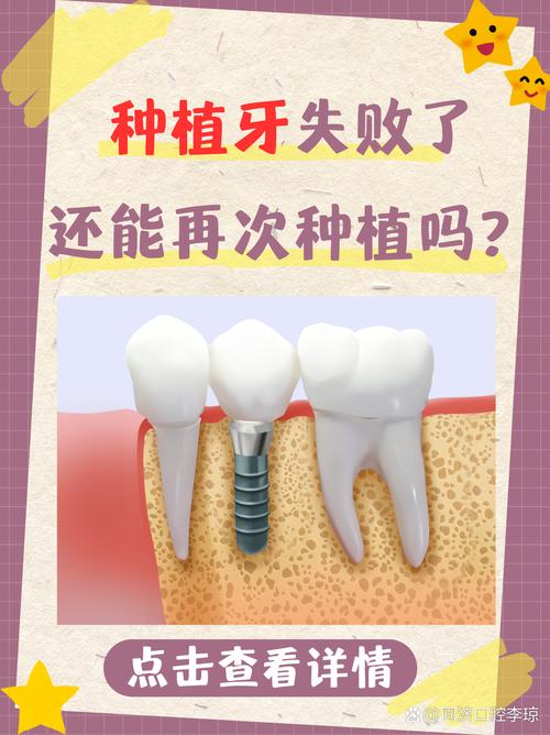 种牙失败后如何处理?这些实用方法要知道-图1 种牙失败后如何处理?这些实用方法要知道-图1
