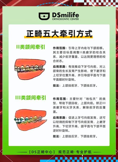 正畸的带环丢了怎么办-图2