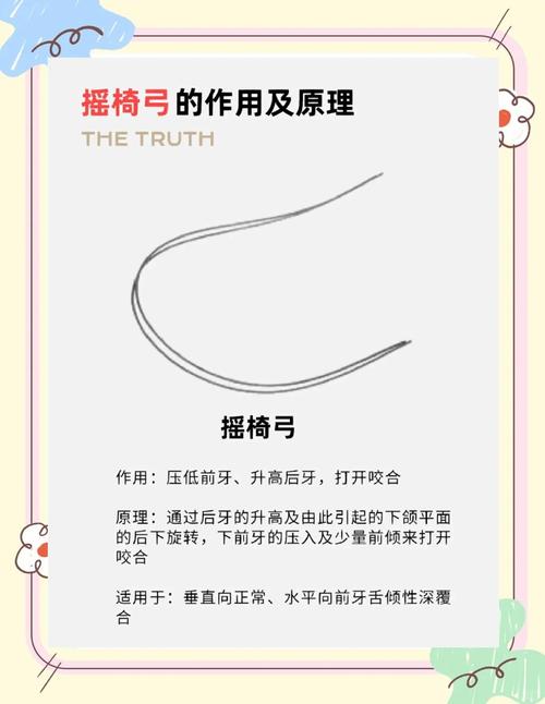 口腔唇弓的制作方法-图2 口腔唇弓的制作方法-图2