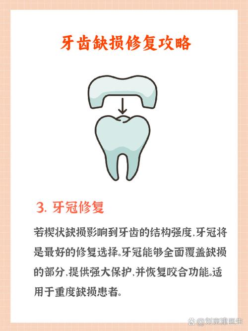牙列缺损修复方法优缺点如何？怎样选最适方案？-图2