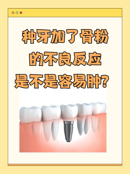 种牙植骨骨粉漏了?原因、风险与应对方法是什么?-图1 种牙植骨骨粉漏了?原因、风险与应对方法是什么?-图1