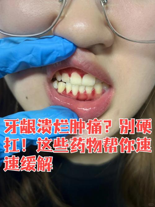 种牙麻药过后疼不疼-图1