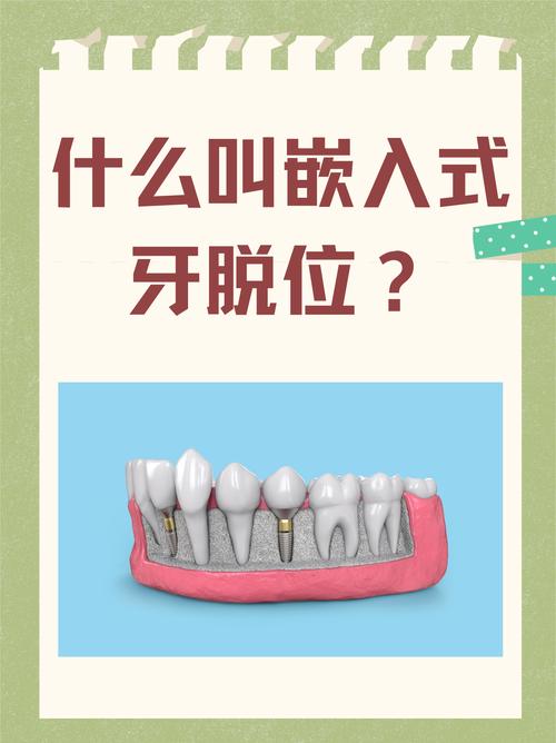 牙较脱位如何正确处理？应急措施与就医步骤有哪些？-图2