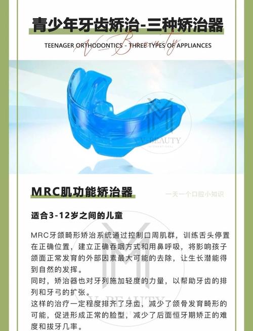 肌功能正畸矫正器厂家如何选?这几点决定靠谱产品与服务!-图2 肌功能正畸矫正器厂家如何选?这几点决定靠谱产品与服务!-图2