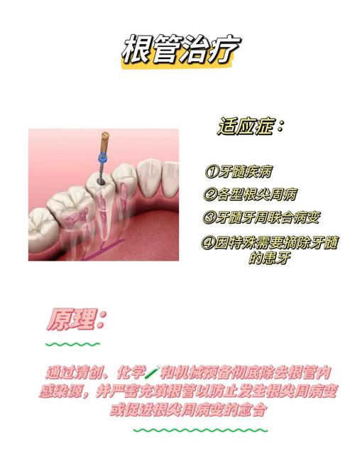 牙科除丁克怎么用?正确使用方法步骤与注意事项详解-图3 牙科除丁克怎么用?正确使用方法步骤与注意事项详解-图3