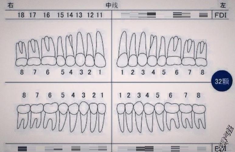 如何正确使用美国牙位记录方法？-图3