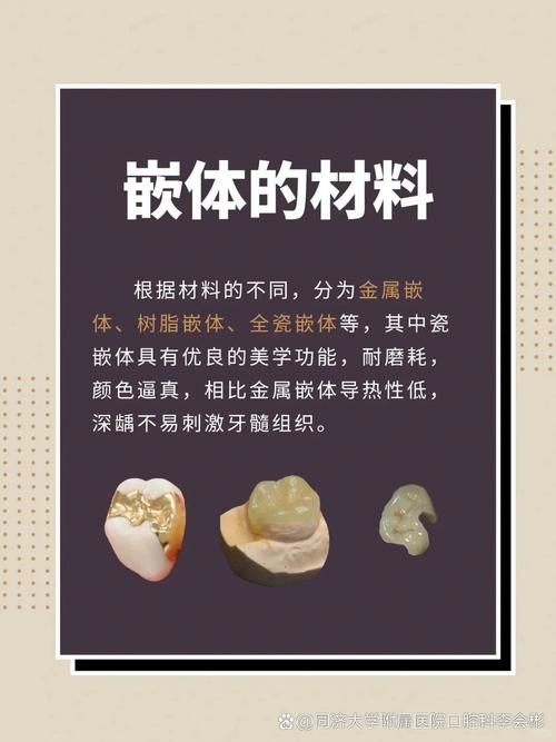 牙体充填术补牙方法-图2 牙体充填术补牙方法-图2