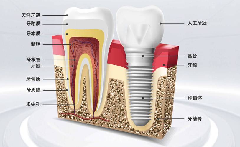 同济口腔为何将种牙设分部？分部种牙有何优势？-图3