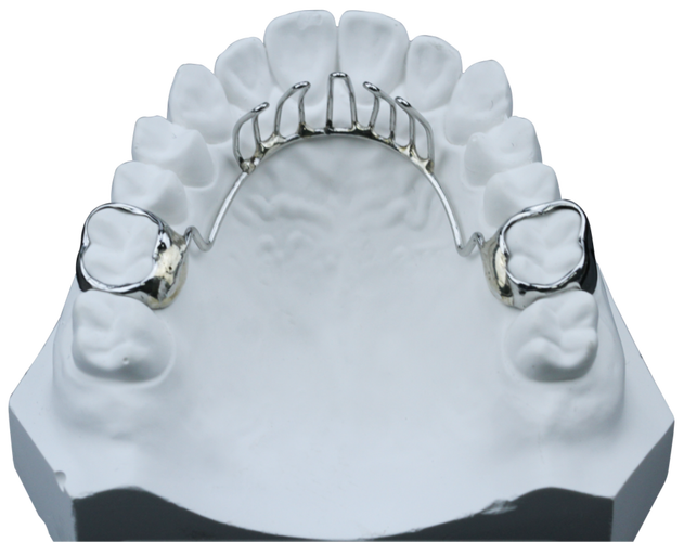 正畸弓丝自带停止扣有何优势？能否提升矫治精准度？-图1