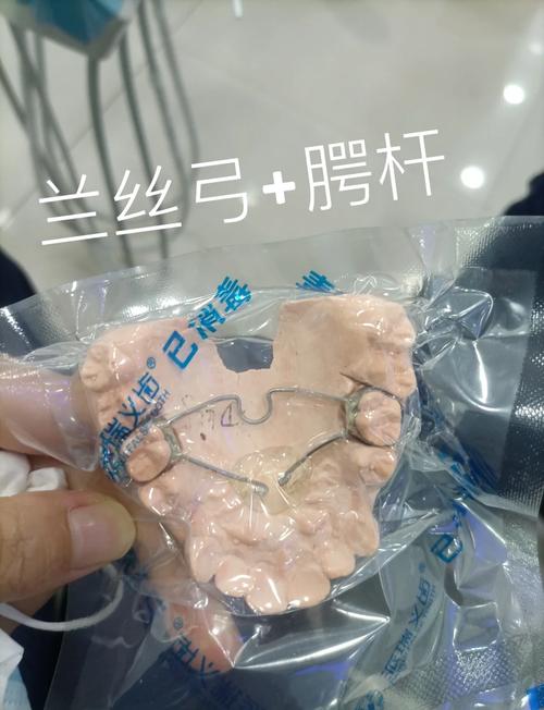 正畸弓丝自带停止扣有何优势？能否提升矫治精准度？-图3