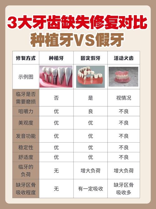 口腔最常见修复方法有哪些？适用情况如何？-图1