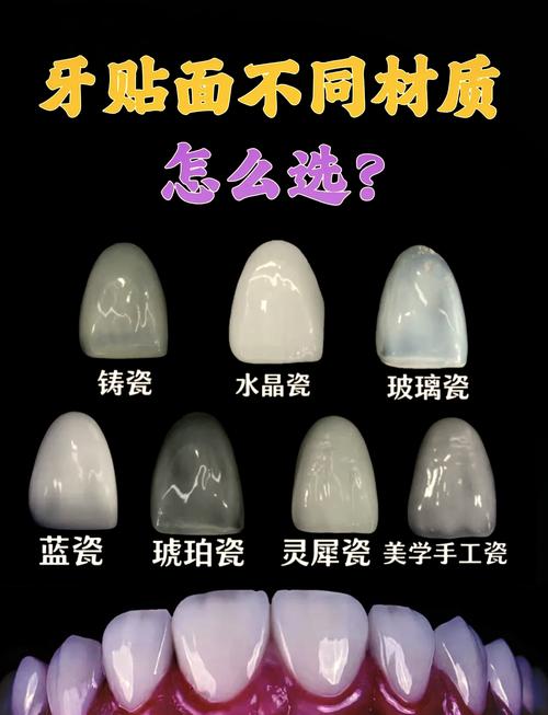 贴面的正确使用方法-图3