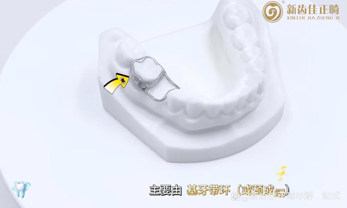 正畸用带环的原因究竟是什么？-图3