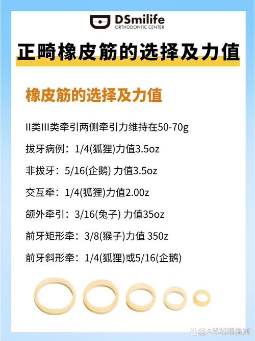 正畸三类牵引皮筋型号有哪些?各自适用于哪些牙齿矫正情况?-图2 正畸三类牵引皮筋型号有哪些?各自适用于哪些牙齿矫正情况?-图2