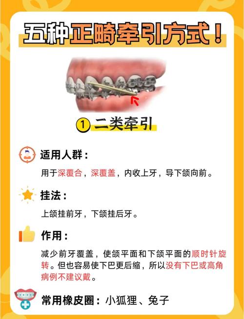 正畸橡皮链如何正确使用?步骤与注意事项详解-图1 正畸橡皮链如何正确使用?步骤与注意事项详解-图1