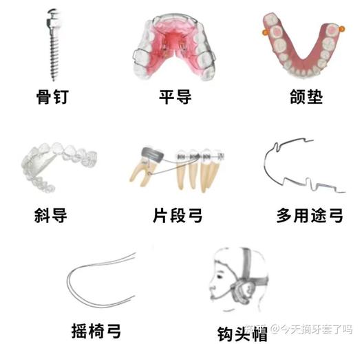 正畸平面导板治疗前后的对照图能看出哪些具体矫正效果?-图1 正畸平面导板治疗前后的对照图能看出哪些具体矫正效果?-图1