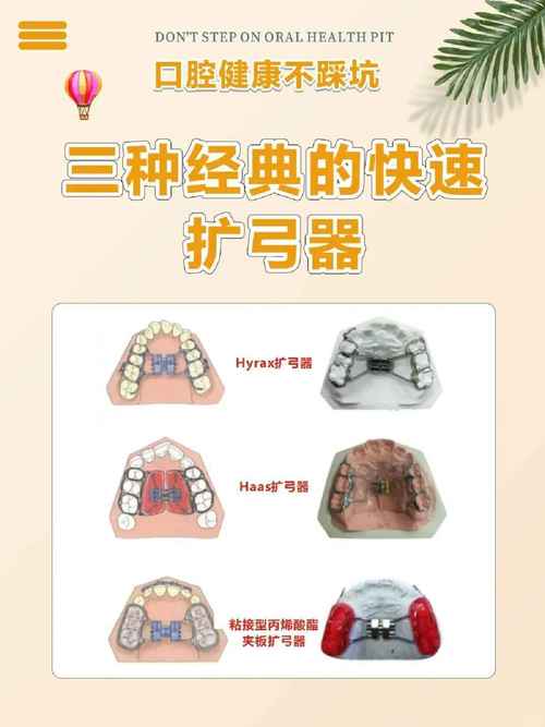 正畸快速扩弓器的简称是什么？-图1