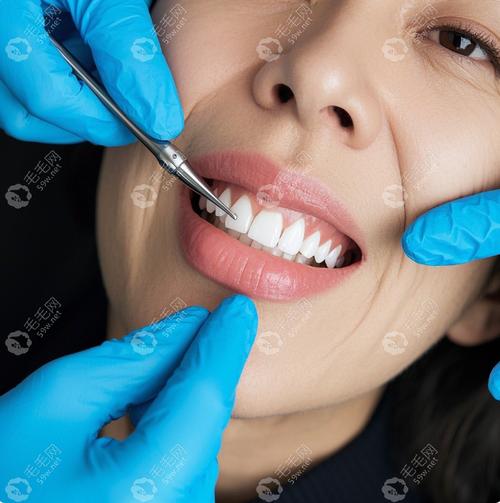 杭州种牙为何选格莱美？它有何独特优势？-图2