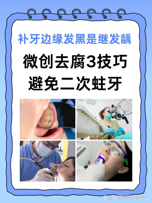 黑牙齿怎么治疗？有哪些有效的治疗方法？-图3