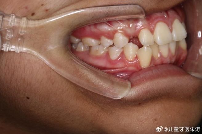 成都正畸齿颚好的牙医如何挑选专业靠谱又经验丰富的呢？-图2