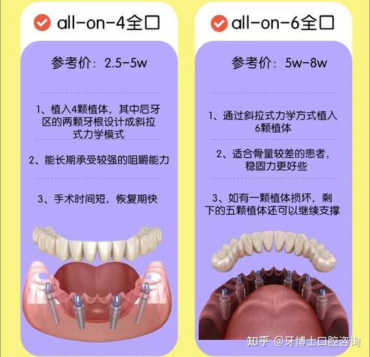 美国缺牙修复，种牙和镶牙哪个更合适？-图2