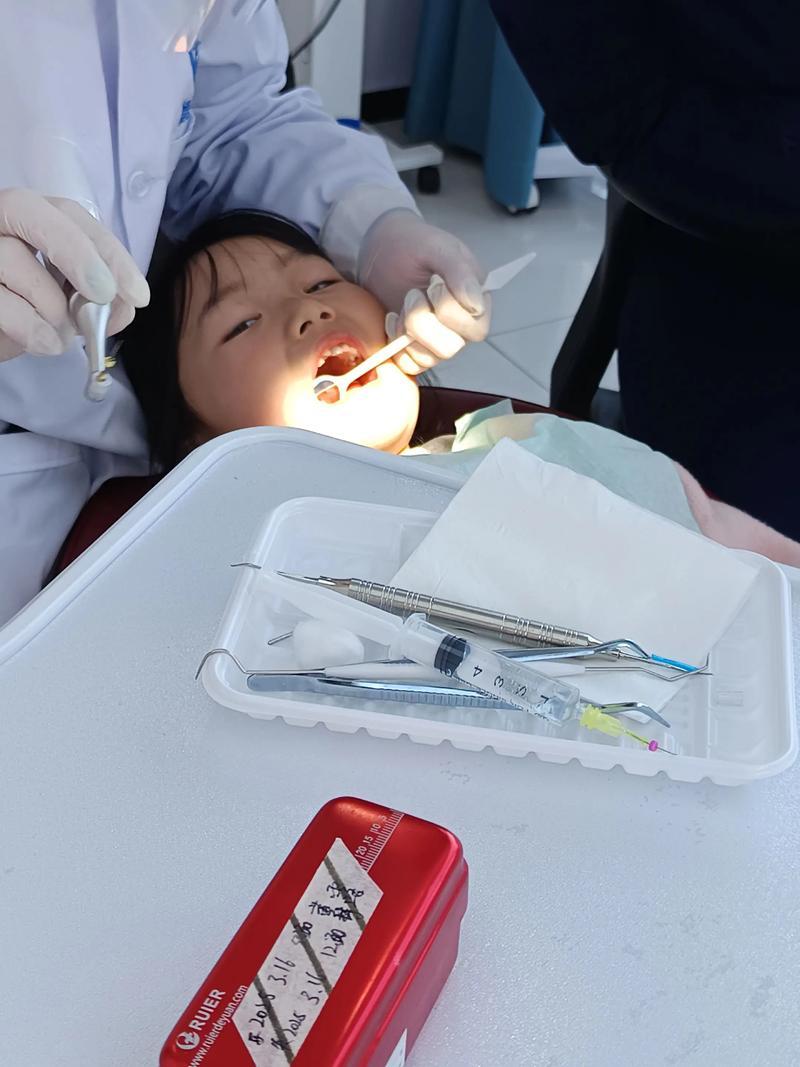 种牙拆线后几天能喝酒？-图1